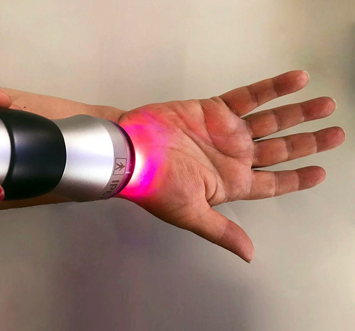 tratamento fotossonico